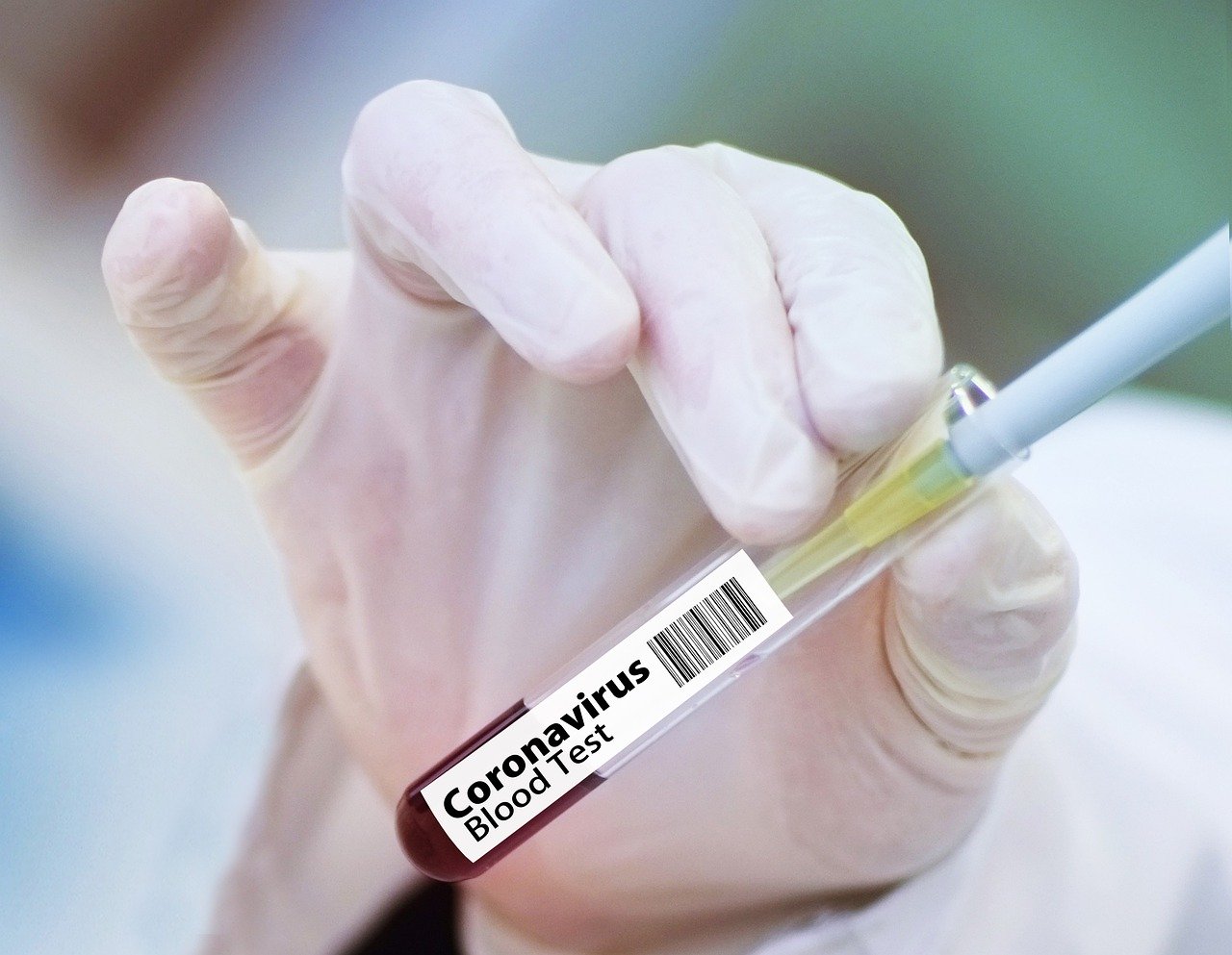 Coronavirus: solo tre contagi in più, aumentano guariti