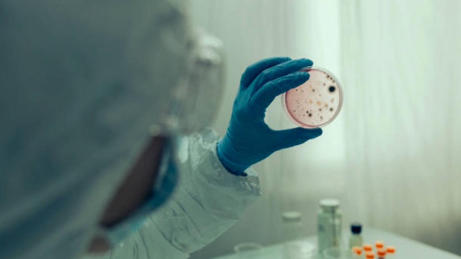 Sardegna, uomo colpito da Colera: accertata l'origine del batterio