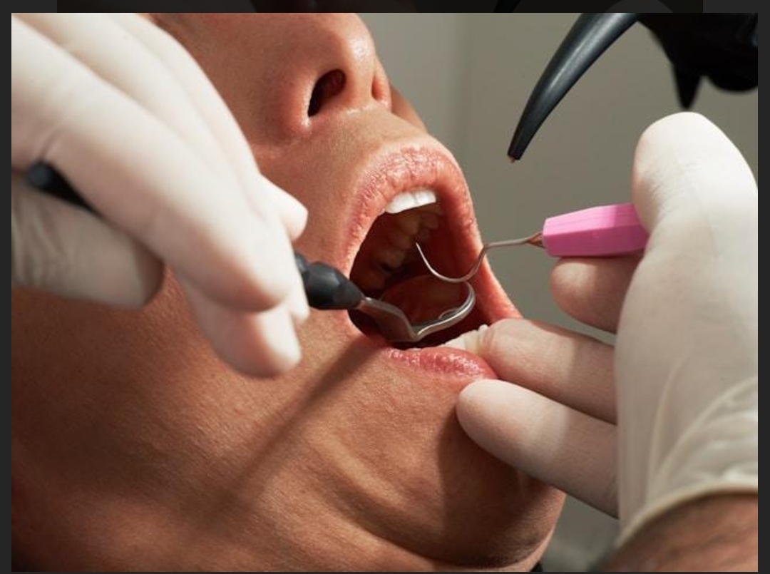 Turismo dentale all'estero? Meglio affidarsi a professionisti italiani